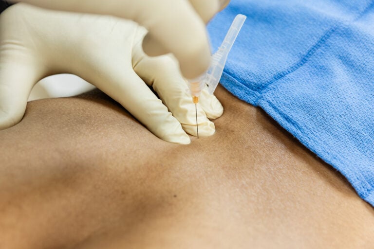Close-up of a subcutaneous injection