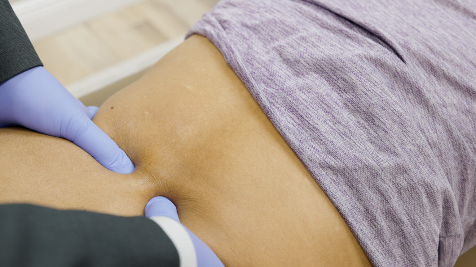 Clinician administering a subcutaneous injection in the abdomen